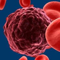 Gilteritinib Takes Step Toward Chinese Approval for FLT3+ AML