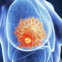 Continuous Chemotherapy Improves TTF But Not OS in ER+/HER2- Advanced Breast Cancer