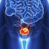 Enfortumab Vedotin Sustains OS Benefit in Locally Advanced or Metastatic Urothelial Cancer