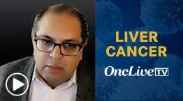 Kabir Mody, MD, discusses the unique approach used to deliver Y-90 glass microspheres to patients with unresectable hepatocellular carcinoma. 