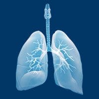 TP53 Mutations Loom Large in Lung Cancer Study