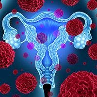 Durvalumab Combo in Advanced Endometrial Cancer | Image Credit: © freshidea - stock.adobe.com