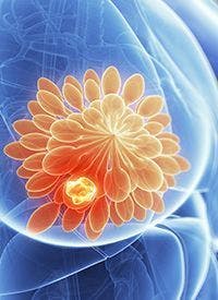 HER2-Positive Metastatic Breast Cancer