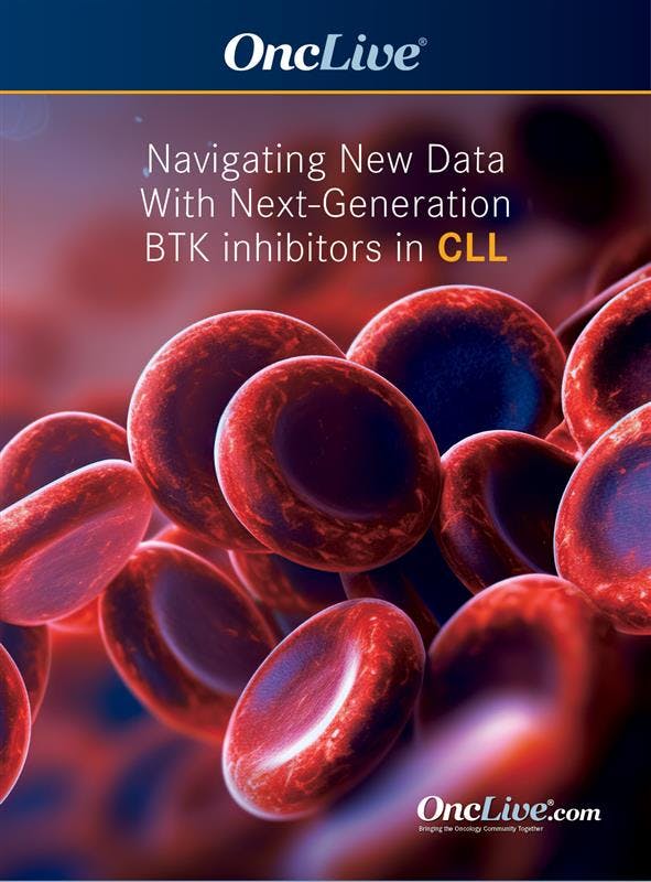 Navigating New Data With Next-Generation BTK Inhibitors in CLL