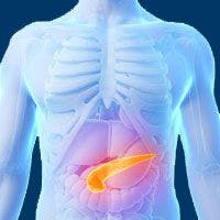 Novel Targets and Biomarkers Emerge in Pancreatic Cancer
