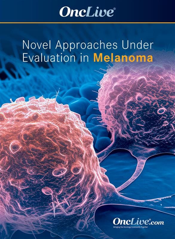 Novel Approaches Under Evaluation in Melanoma
