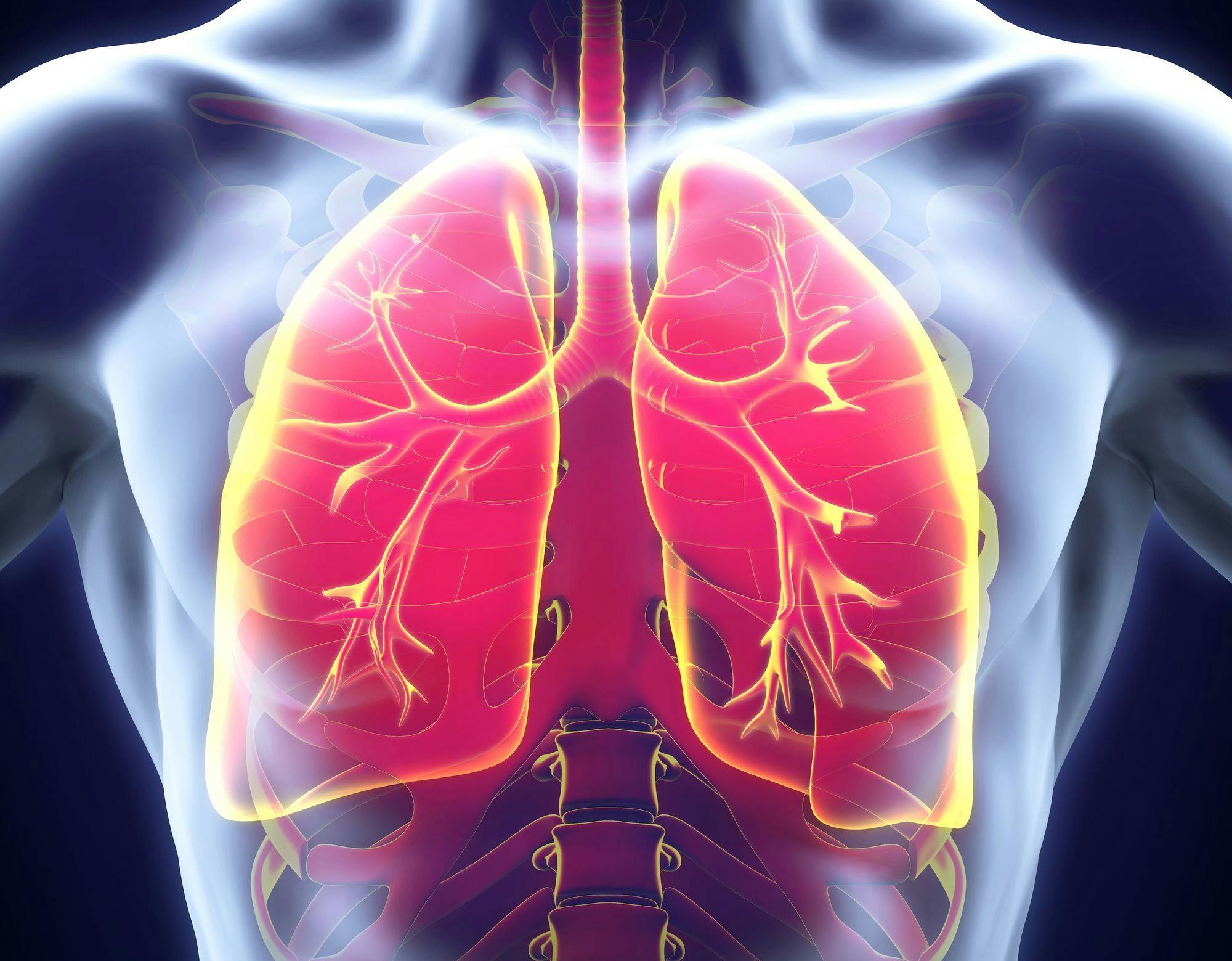 Boosting Lung Cancer Screening Will Improve Survival