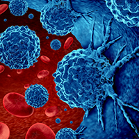 Cancer in the blood outbreak and treatment for malignant cells in a human body caused by carcinogens and genetics with a cancerous cell as an immunotherapy and leukemia or lymphoma symbol and medicalImage Credit: © freshidea - stock.adobe.com