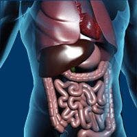 Treatment, Diagnosis Disparities Among Hospitals Impacts Survival of Patients With Colorectal Cancer and Peritoneal Metastases