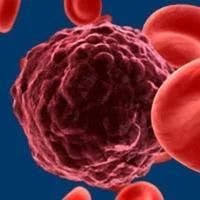 Frontline Venetoclax-Based Combos Improve uMRD Rates Vs Chemoimmunotherapy in Fit Patients With CLL