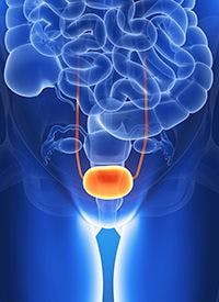 TLD-1433 in non–muscle invasive bladder cancer - stock.adobe.com