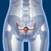 The combination of mirvetuximab soravtansine and rucaparib was found to be well tolerated, with encouraging activity reported in heavily pretreated patients with endometrial, ovarian, fallopian tube, or primary peritoneal cancer.