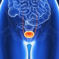 3d rendered illustration - bladder cancer: © Sebastian Kaulitzki - stock.adobe.com