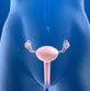 NICE Recommends Olaparib Maintenance in Relapsed, Platinum-Sensitive Ovarian Cancer