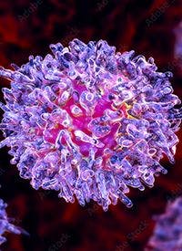 Hairy Cell Leukemia (Kateryna_Kon - stock.adobe.com) 

