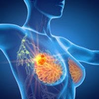 Camizestrant Provides Survival Benefit Vs Fulvestrant in ER+/HER2- Advanced Breast Cancer