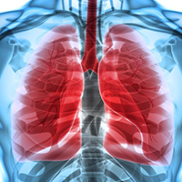 UK Accepts Marketing Authorization Application for Sugemalimab in Metastatic NSCLC
