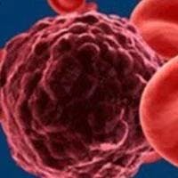 MPL Mutations Linked to Increased Risk of Myelofibrosis Transformation in Essential Thrombocythemia