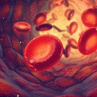 Crovalimab Demonstrates Noninferiority to Eculizumab in Phase 3 COMMODORE 2 Trial in PNH
