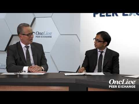 Treatment Strategies for Early-Stage HCC