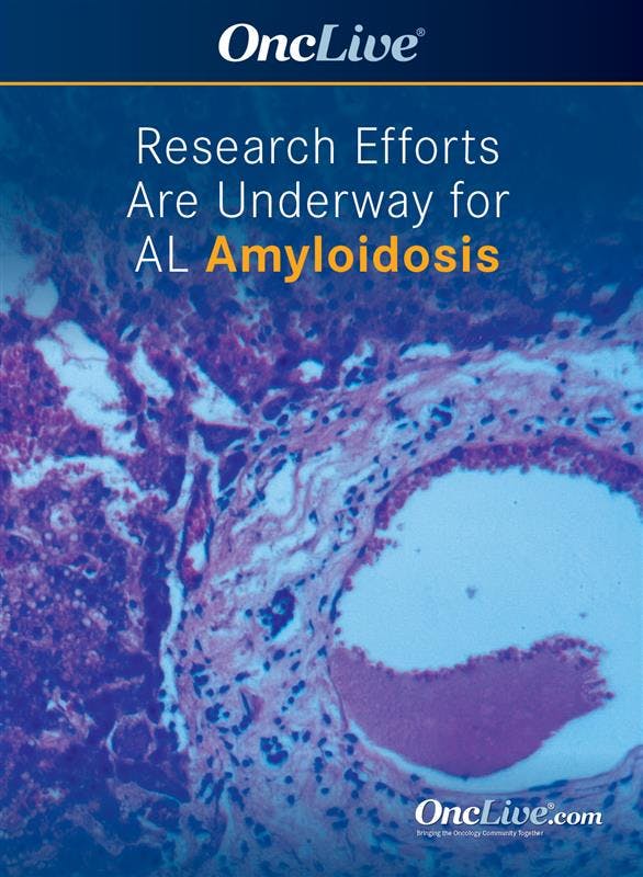 Research Efforts Are Underway for AL Amyloidosis