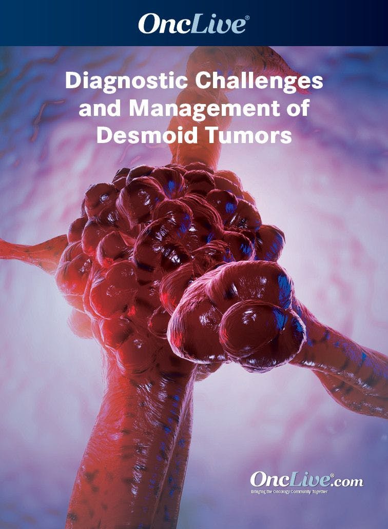Diagnostic Challenges and Management of Desmoid Tumors