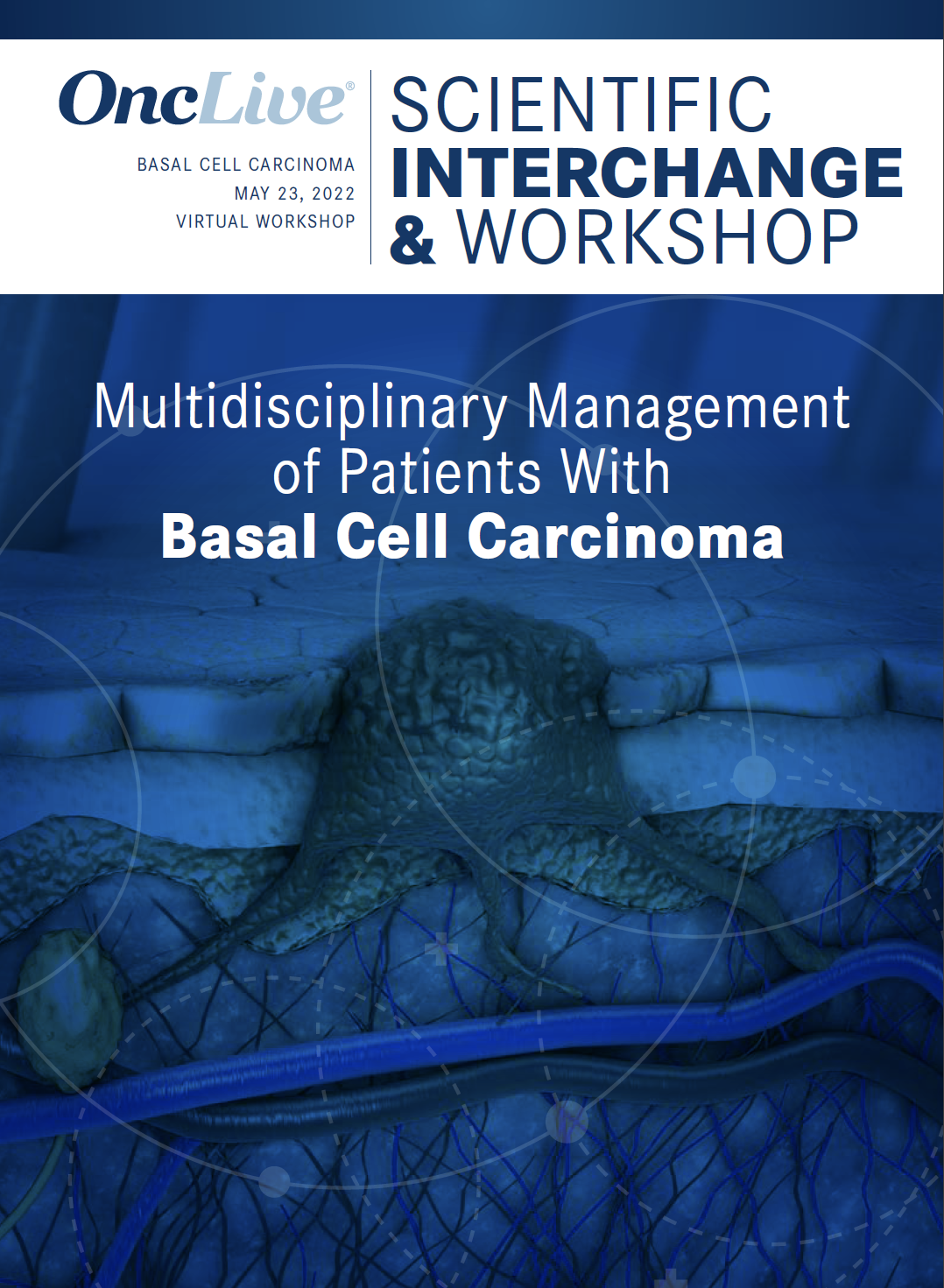 Multidisciplinary Management of Patients with Basal Cell Carcinoma