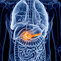 The NALIRIFOX regimen significantly improved overall survival over nab-paclitaxel plus gemcitabine in previously untreated patients with metastatic pancreatic ductal adenocarcinoma, meeting the primary end point of the phase 3 NAPOLI 3 trial.
