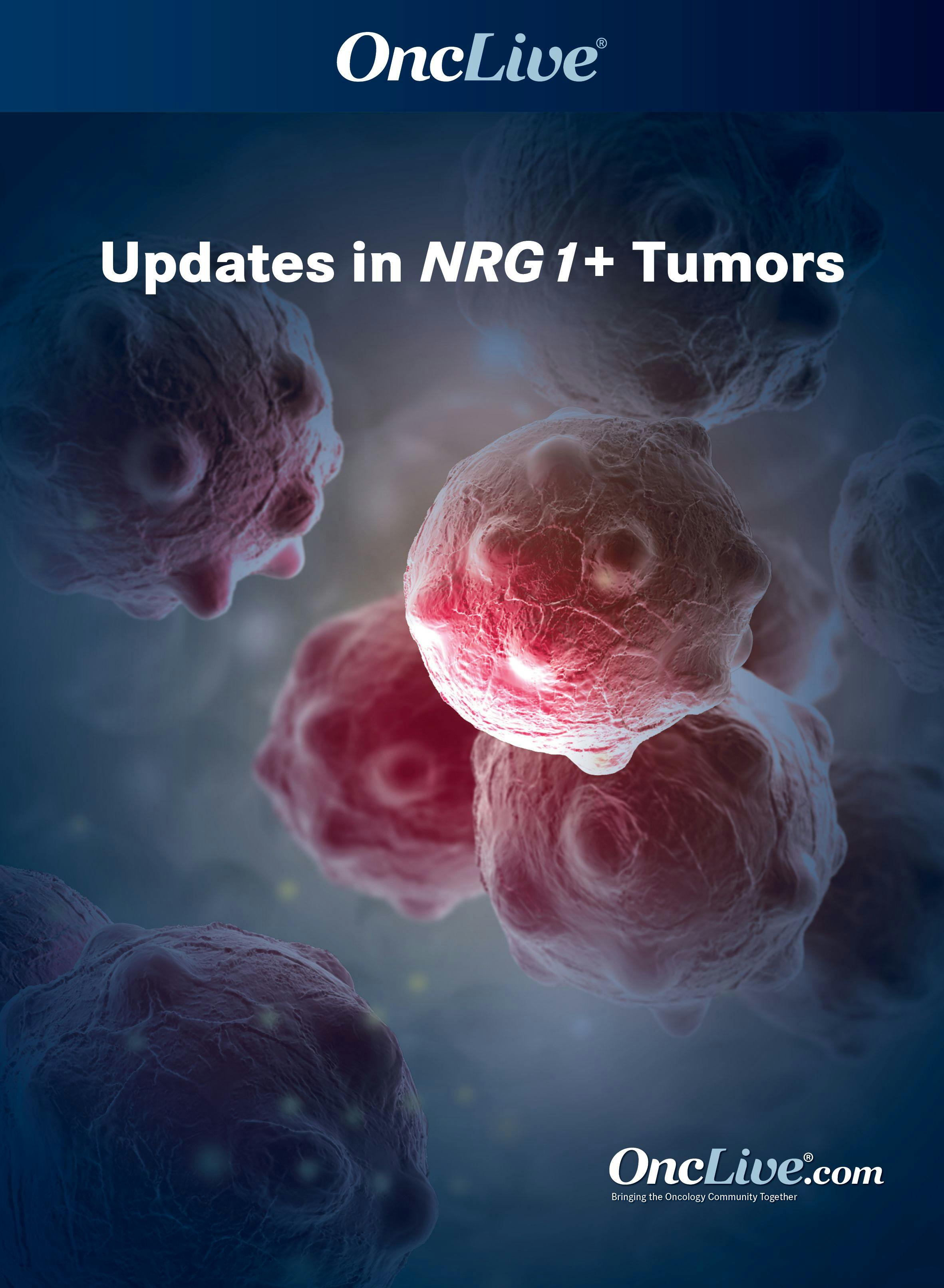 Updates in NRG1+ Tumors