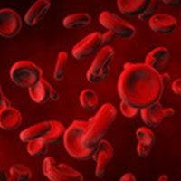 Momelotinib Approaches EU Approval for Myelofibrosis With Anemia
