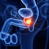 Gaps in Validated Quality Indicator Use in Low-Risk Prostate Cancer | Image Credit: © SciePro - stock.adobe.com
