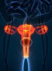 Ovarian Cancer | Image Credit: ©   magicmine - stock.adobe.com