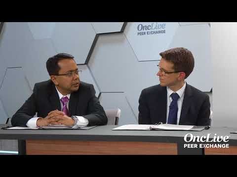 Personal Approaches to Treating Brain Metastasis in RCC 