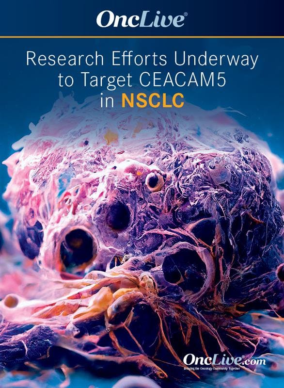 Research Efforts Underway to Target CEACAM5 in NSCLC