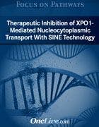 Focus on Pathways: Therapeutic Inhibition of XPO1- Mediated Nucleocytoplasmic Transport With SINE Technology