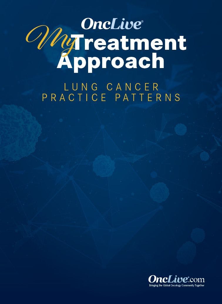 My Treatment Approach: Lung Cancer Practice Patterns
