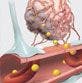 Attacking the Blood-Brain Barrier: New Strategies for Primary and Metastatic Brain Tumors Abound