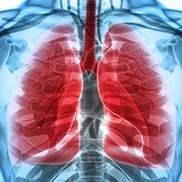 Weekly Webinar Series Part 5: Managing Lung Cancer Patients Through the COVID-19 Pandemic