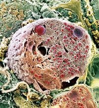 Pancreas cell, SEM