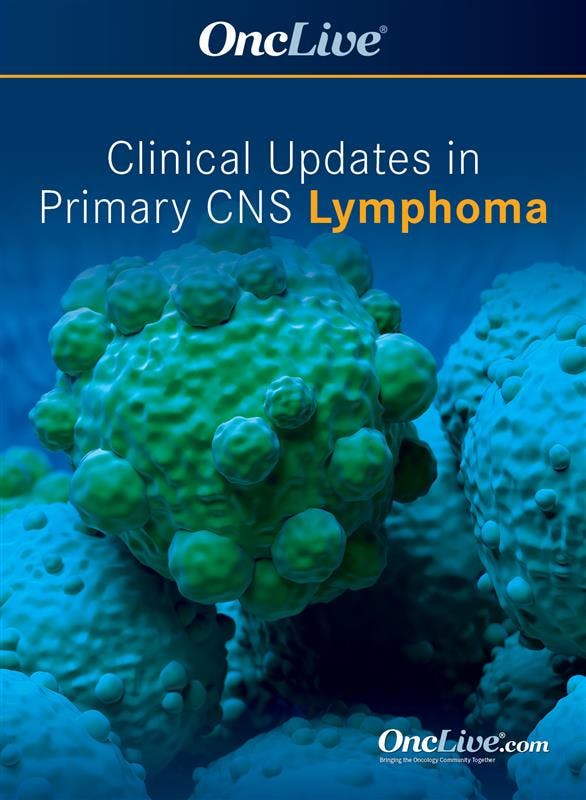 Clinical Updates in Primary CNS Lymphoma