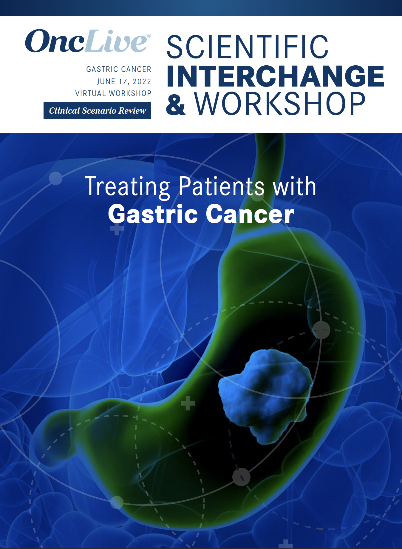 Treating Patients with Gastric Cancer