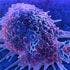 Pembrolizumab Combination Study Planned in Prostate Cancer