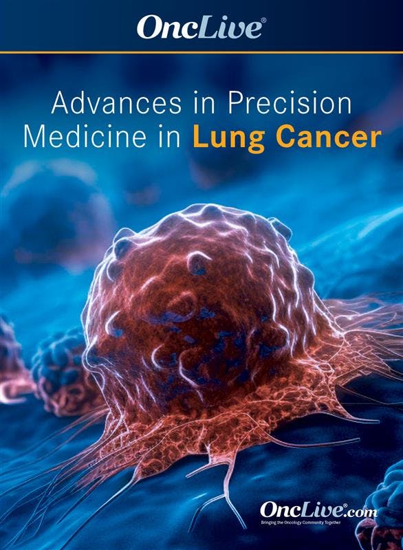 Advances in Precision Medicine in Lung Cancer