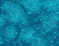 Human embryonic stem cell colonies that are not yet differentiated