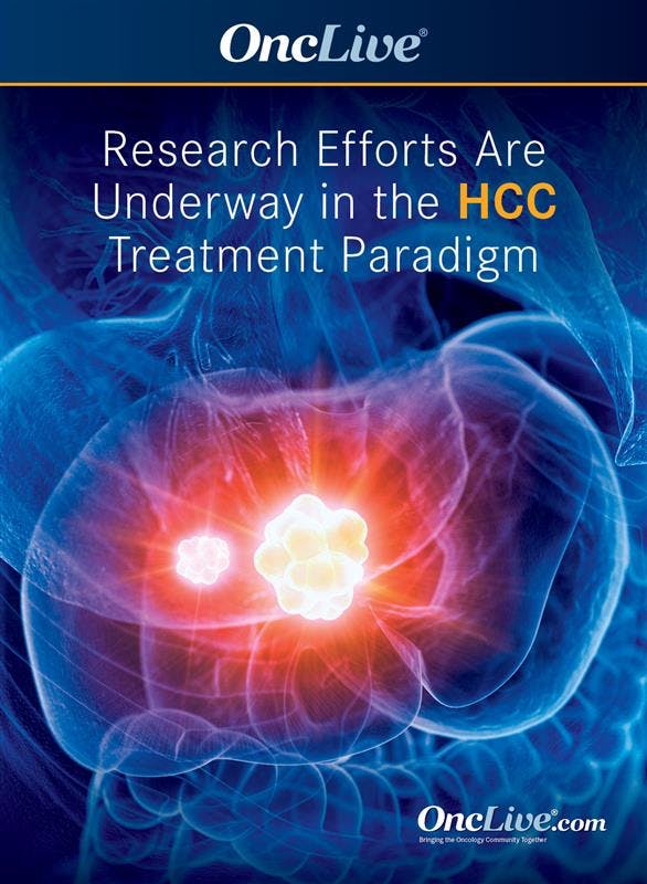 Research Efforts Are Underway in the HCC Treatment Paradigm