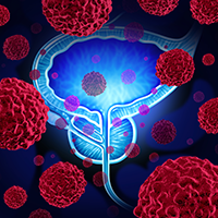 Darolutamide was found to have a favorable safety and tolerability profile in patients with metastatic castration-resistant prostate cancer who were enrolled to the phase 1 ARAFOR study and received extended treatment with the agent for more than 4 years.