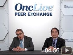 Global Perspective on Treatment of Hepatocellular Carcinoma