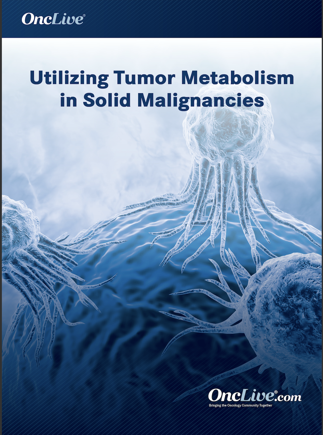 Utilizing Tumor Metabolism in Solid Malignancies