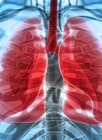 Lung Cancer: ©  stock.adobe.com