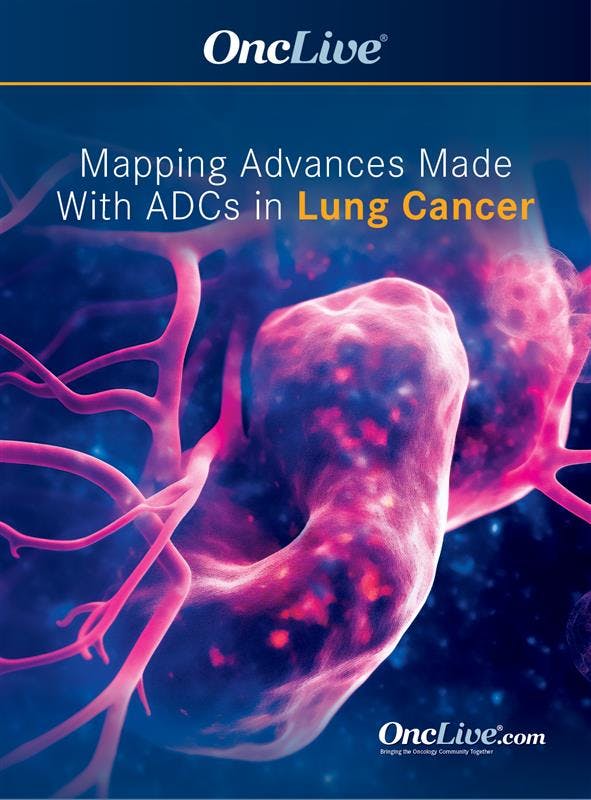 Mapping Advances Made With ADCs in Lung Cancer